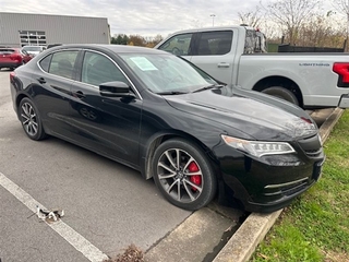 2016 Acura Tlx